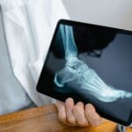Así son las infiltraciones ecoguiadas para tratar el dolor en el pie